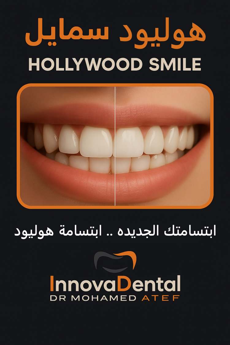 Hollywood Smile